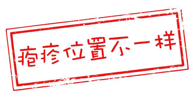 孩儿乐教你分清手足口病、疱疹性咽峡炎和水痘