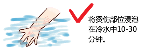 孩子急救：烧烫伤急救怎么做？