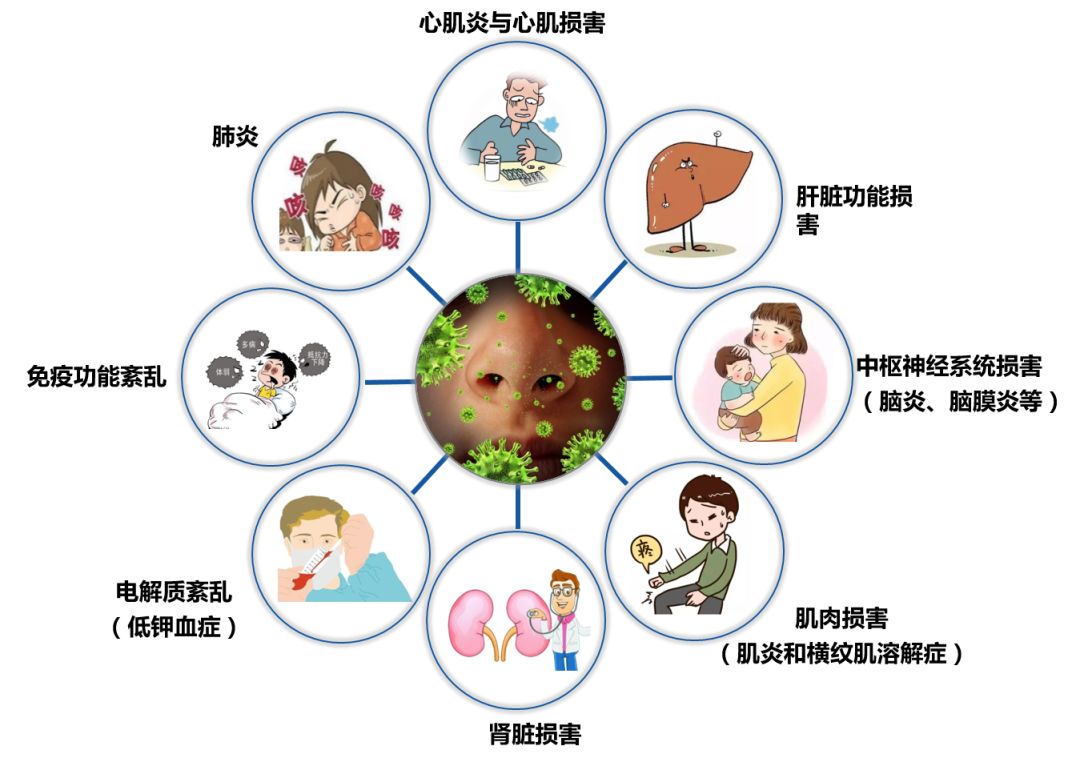 流感容易诱发的并发症
